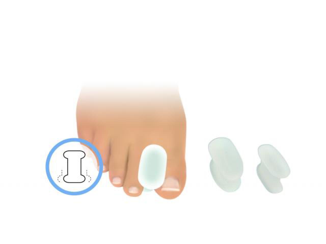 FRESCO Zehenspreizer | Zehenteiler aus Polymer Gel - dicke Form Größe: S