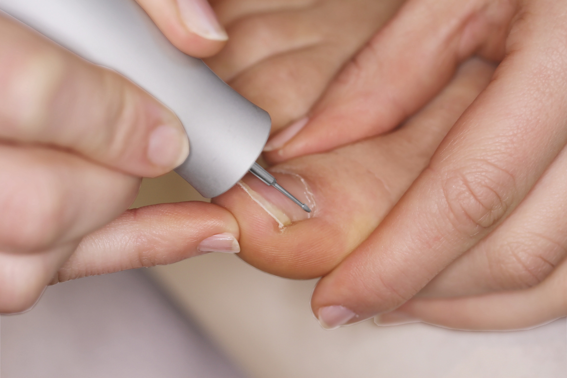 Busch Ony Clean Fräser kurze Form Ø 1,2 mm 2 Stück